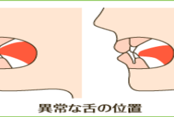<br />
<b>Warning</b>:  Undefined variable $image in <b>/home/xs041540/moto-od.jp/public_html/wp/wp-content/themes/moto10/page-index.php</b> on line <b>247</b><br />
<br />
<b>Warning</b>:  Trying to access array offset on value of type null in <b>/home/xs041540/moto-od.jp/public_html/wp/wp-content/themes/moto10/page-index.php</b> on line <b>247</b><br />
